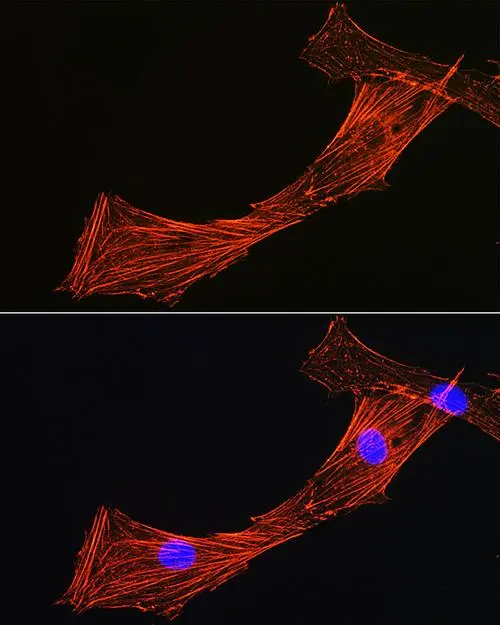 Rhodamine-Phalloidin罗丹明标记鬼笔环肽（橙红）